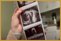 Counting On Alum Joy-Anna Forsyth Updates At 33 Weeks Pregnant